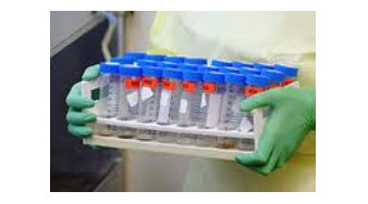 فهرست آزمایشات مولکولی بیولوژی(PCR)