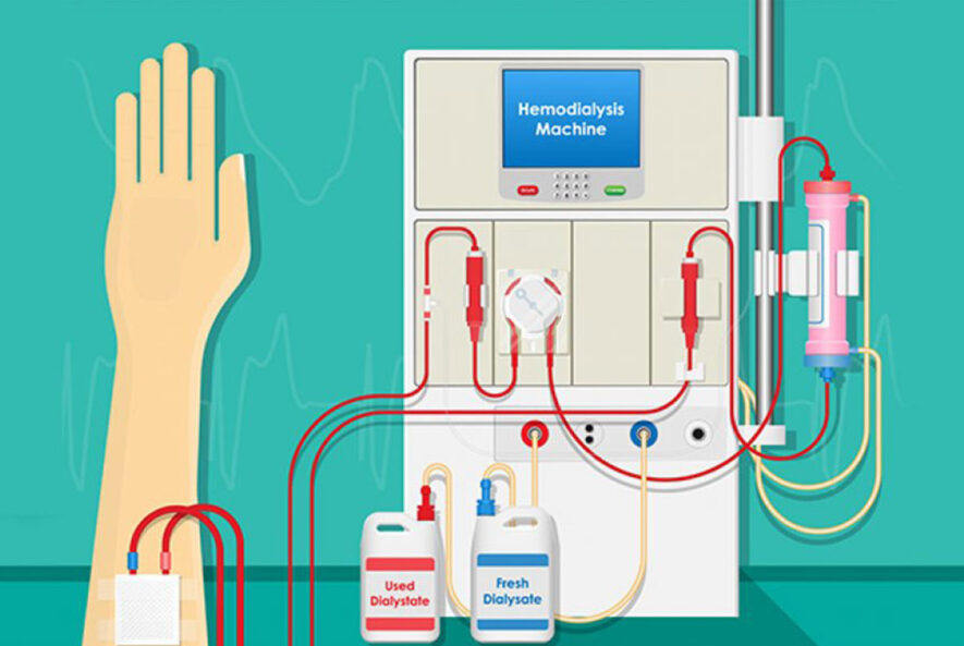 بررسی کیفیت آب مورد استفاده در دستگاه همودیالیز
