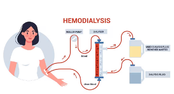 آزمایشات آب دستگاه همودیالیز آزمایشات آب دستگاه همودیالیز