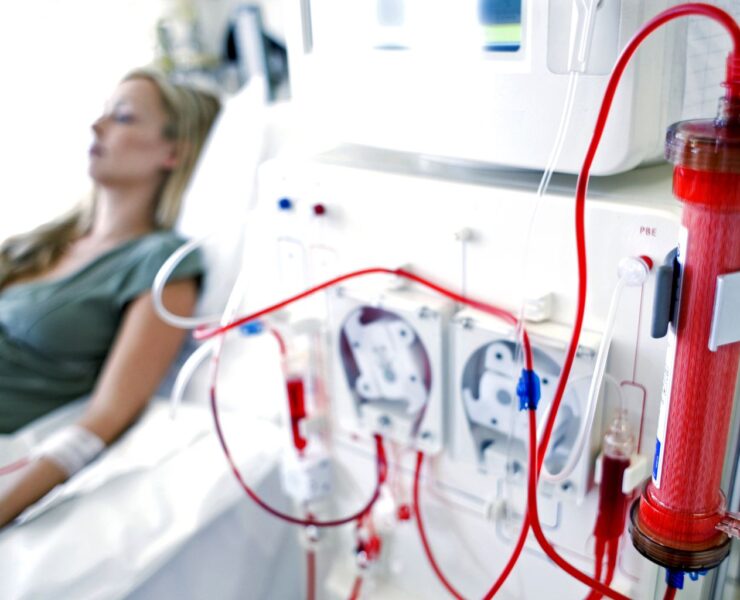 RENAL_DIALYSIS-56a275235f9b58b7d0cac1e2